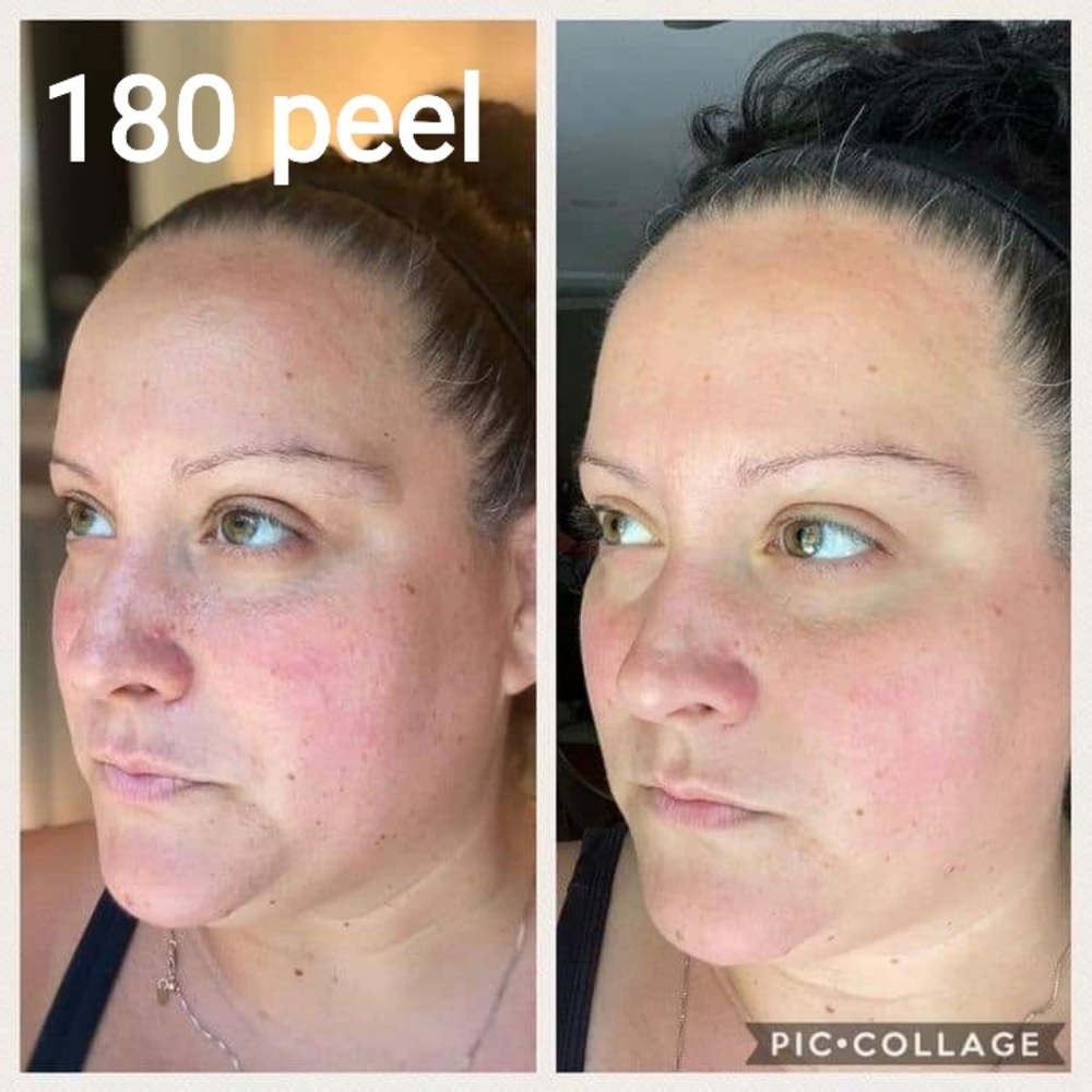 Facial Peel and Neutralizer Nu Skin 180°® AHA